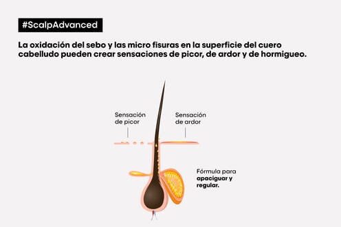 Champú Anti-Malestar Scalp Advanced - L' Oreal Professionnel