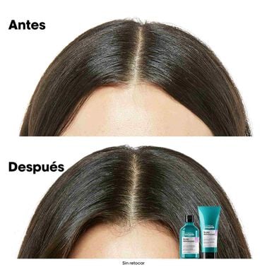 Champú Anti-Malestar Scalp Advanced - L' Oreal Professionnel